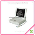 My-A004 Ultrasound Scan Machine & Veterinary Ultrasound